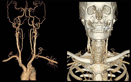 臨床画像技術学-3D-CT
