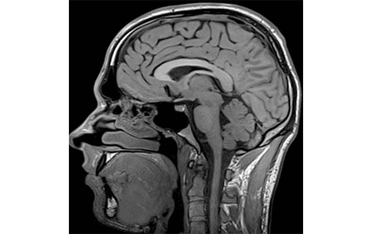 臨床画像技術学-MRI